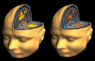 Más neuromarketing